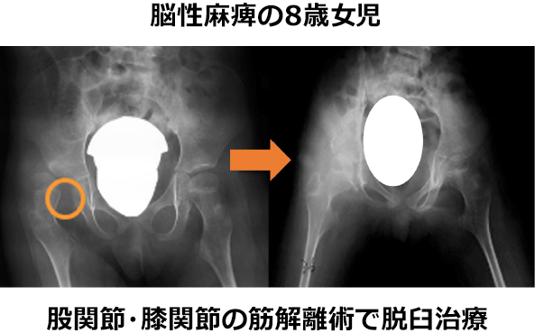 整形外科手術